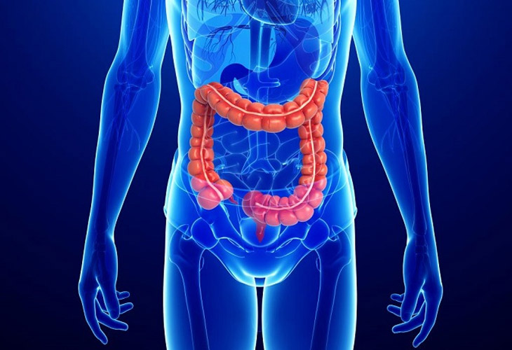 benh crohn
