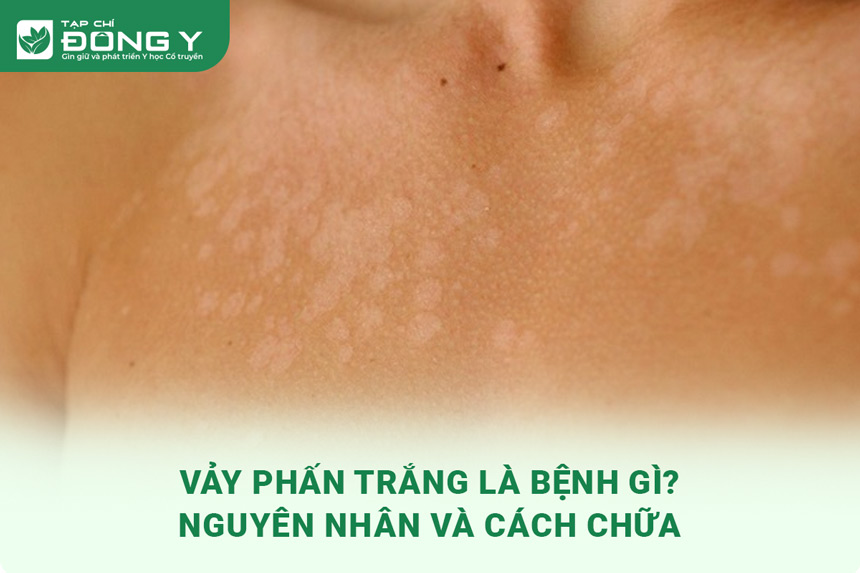 vay phan trang