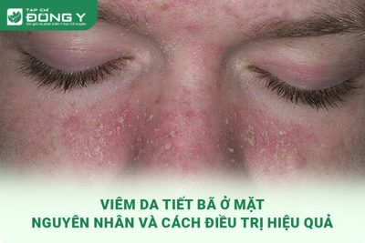 viem da tiet ba o mat