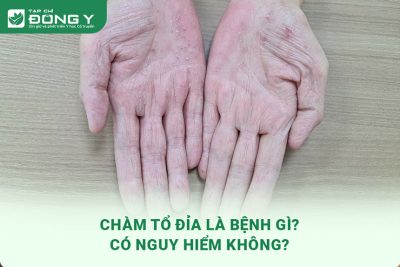 cham-to-dia