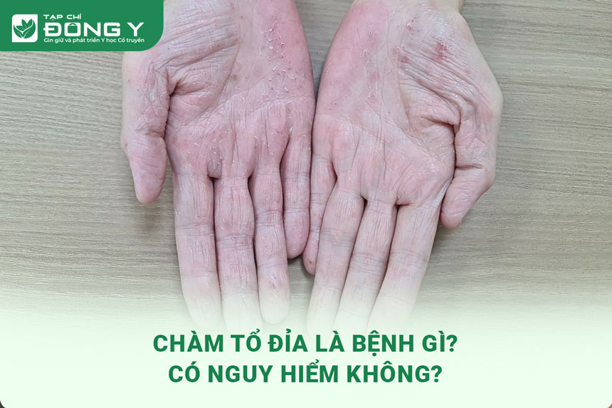 cham-to-dia