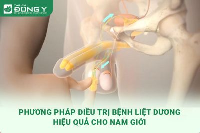 dieu-tri-benh-liet-duong