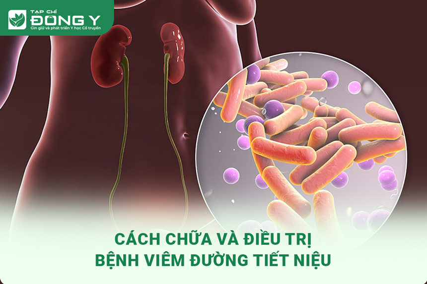 dieu tri benh viem duong tiet nieu