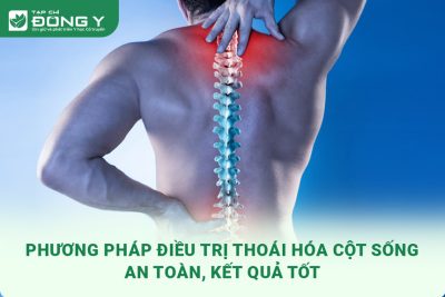 dieu-tri-thoai-hoa-cot-song