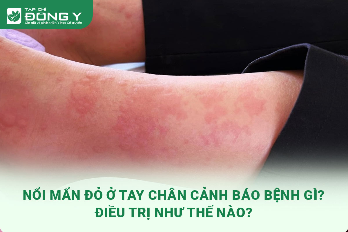 noi-man-do-o-tay-chan