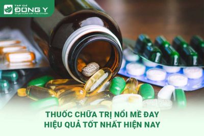 thuoc-chua-tri-noi-me-day