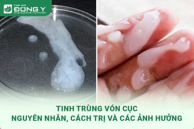 tinh-trung-von-cuc