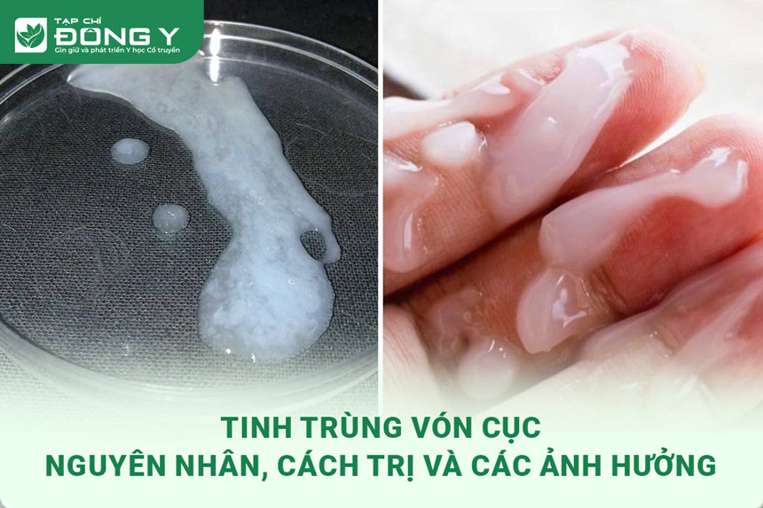 tinh-trung-von-cuc