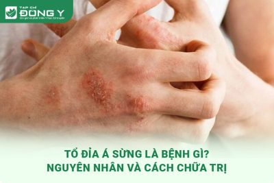 to-dia-a-sung