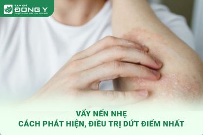 vay-nen-nhe