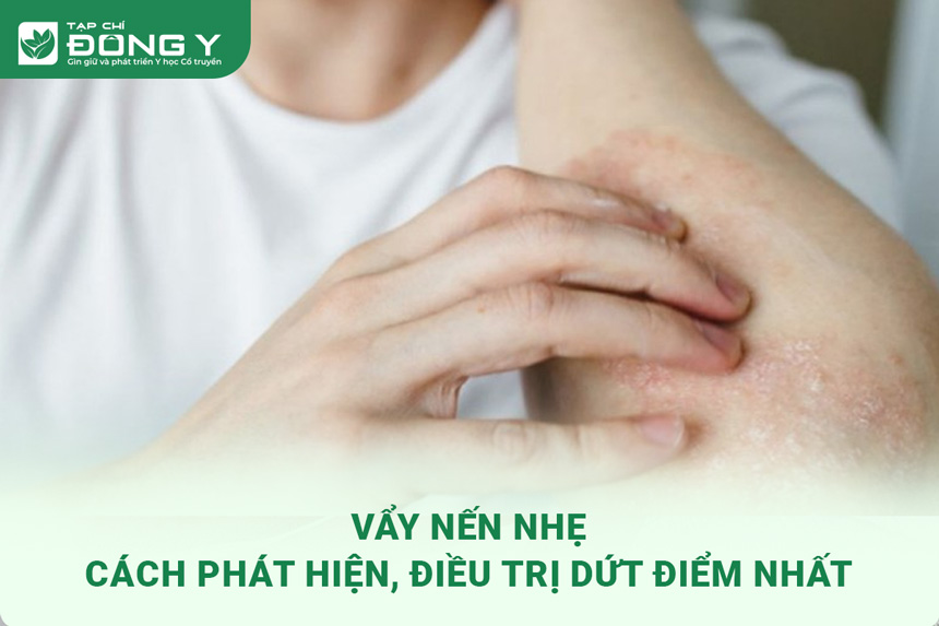 vay-nen-nhe