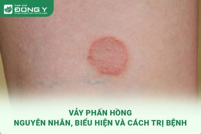 vay-phan-hong