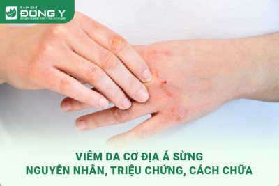 viem-da-co-dia-a-sung