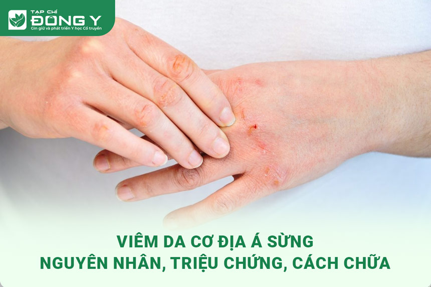 viem-da-co-dia-a-sung