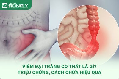 viem-dai-trang-co-that