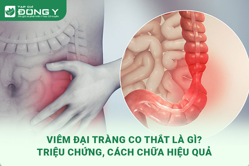 viem-dai-trang-co-that