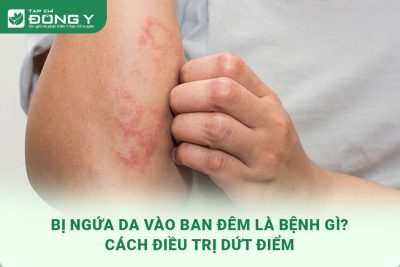 bi-ngua-da-vao-ban-dem
