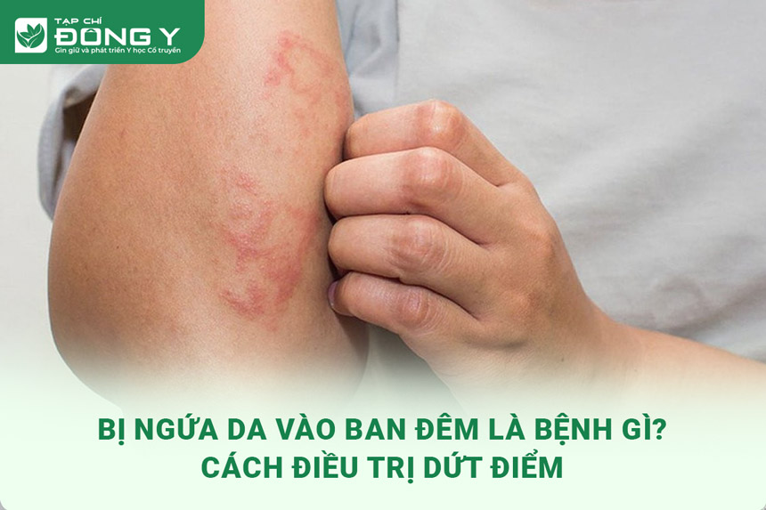 bi-ngua-da-vao-ban-dem
