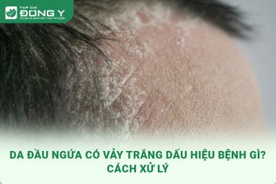 da-dau-ngua-co-vay-trang