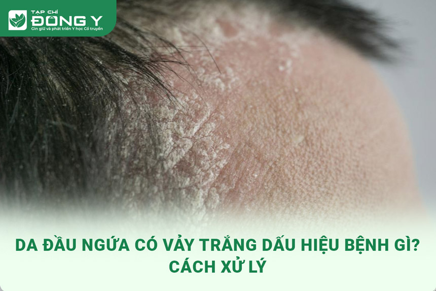 da-dau-ngua-co-vay-trang