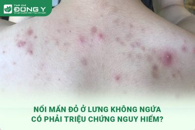 noi-man-do-o-lung-khong-ngua