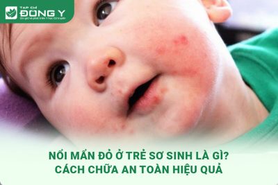noi-man-do-o-tre-so-sinh