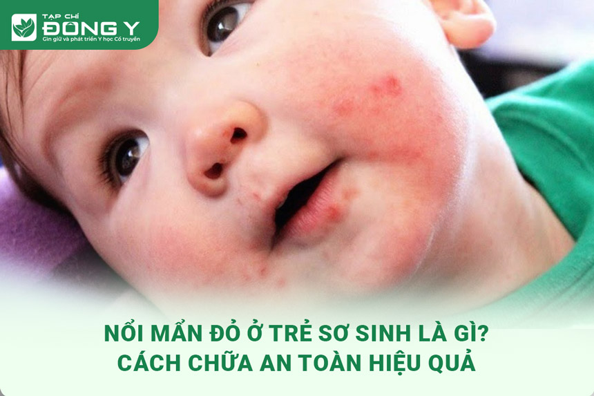 noi-man-do-o-tre-so-sinh