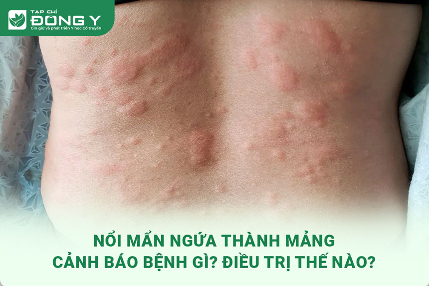 noi-man-ngua-thanh-mang