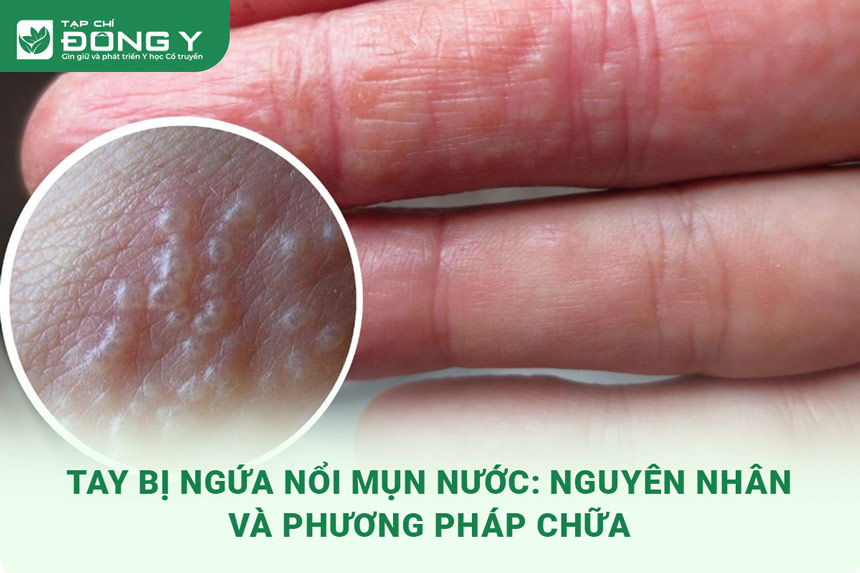 tay-bi-ngua-noi-mun-nuo