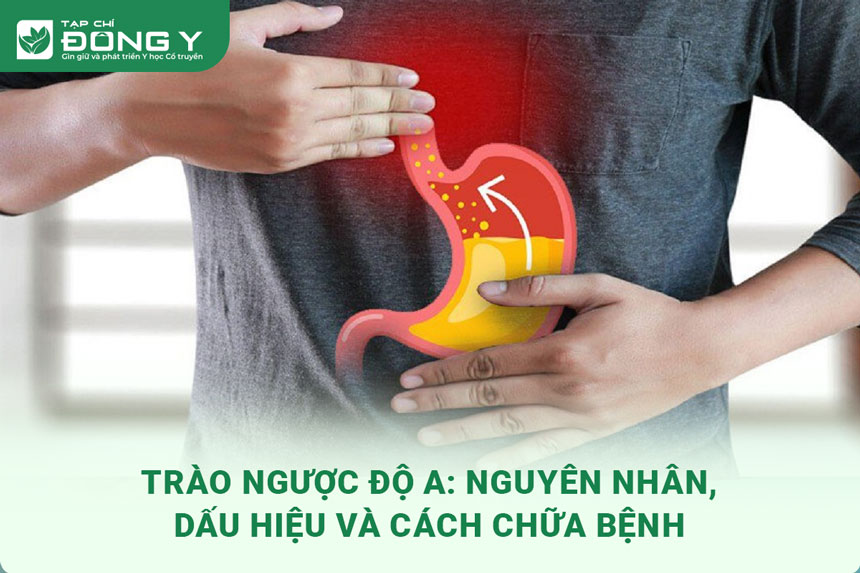 trao-nguoc-do-a