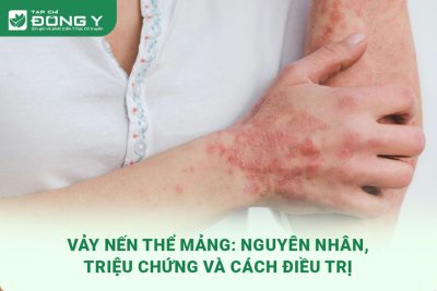 vay-nen-the-mang