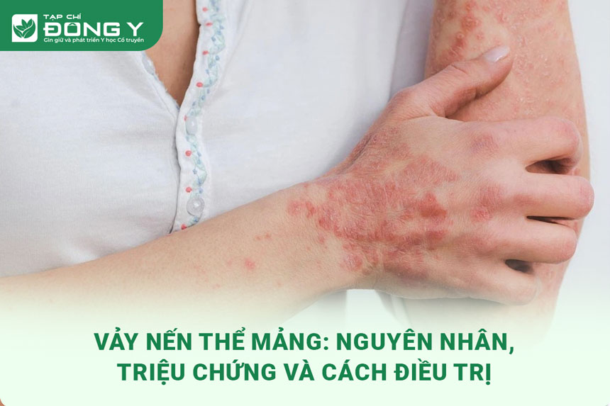 vay-nen-the-mang