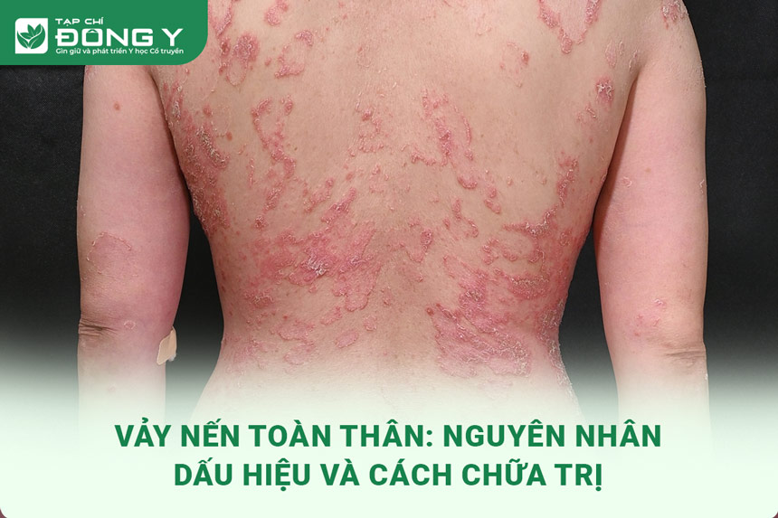 vay-nen-toan-than