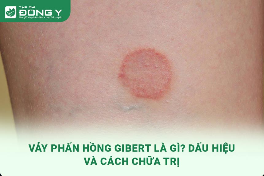 vay-phan-hong-gibert