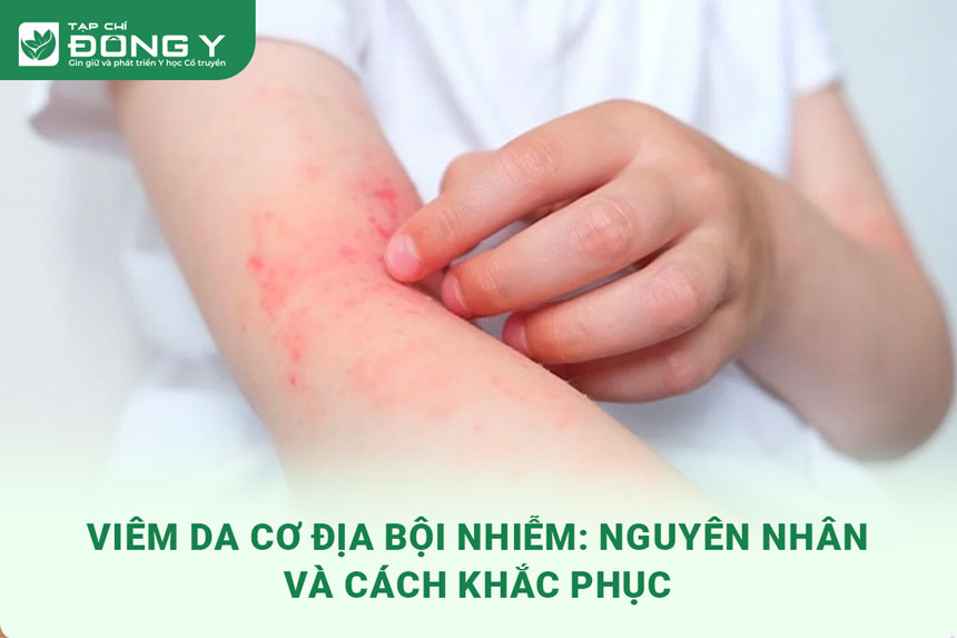 viem-da-co-dia-boi-nhiem