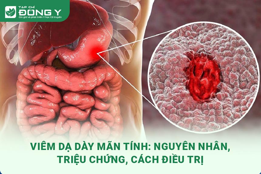 viem-da-day-man-tinh