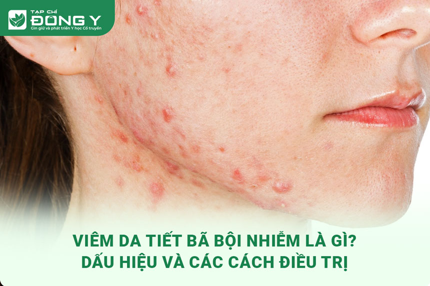 viem-da-tiet-ba-boi-nhiem