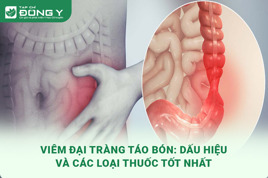 viem-dai-trang-tao-bon