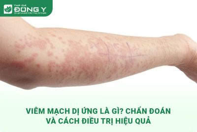 viem-mach-di-ung