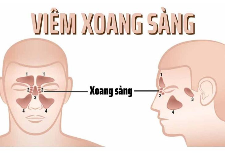viem-xoang-sang-2-ben