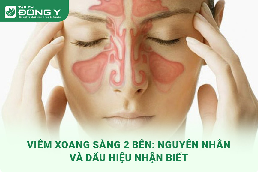 viem-xoang-sang-2-ben