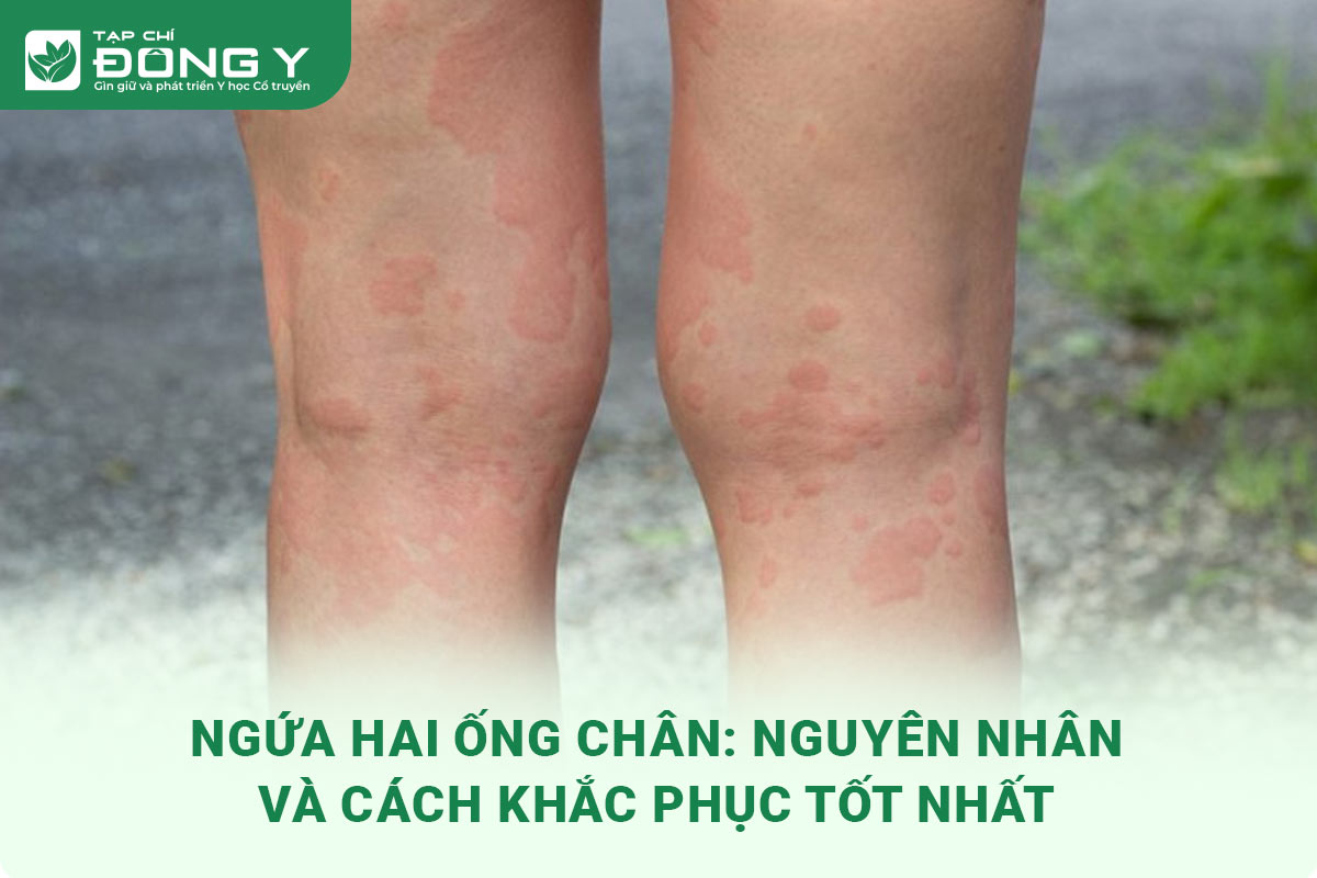 ngua-hai-ong-chan