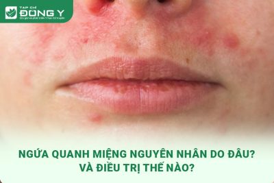 ngua-quanh-mieng