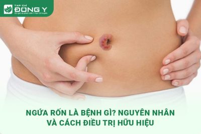 ngua-ron
