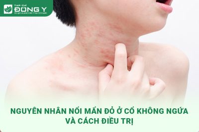 noi-man-do-o-co-khong-ngua