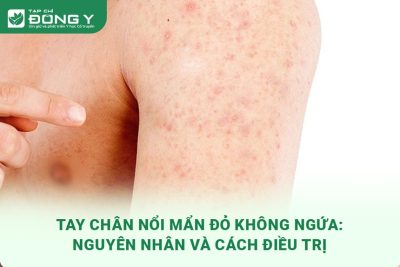 tay-chan-noi-man-do-khong-ngua