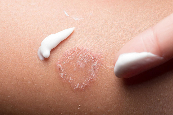 Thuốc được dùng để điều trị các bệnh ngoài da Thuốc được dùng để điều trị các bệnh ngoài da