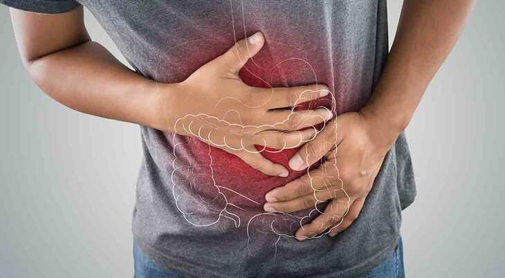 Nhiều nguyên nhân dẫn đến viêm đại tràng sôi bụng