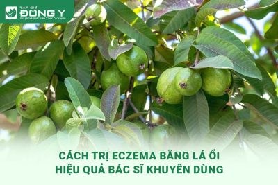 tri-eczema-bang-la-oi
