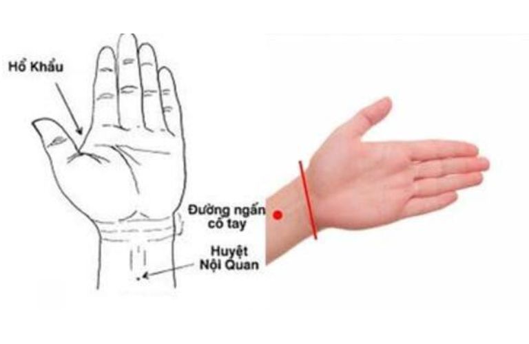 Vị trí huyệt nội quan chữa xuất tinh sớm